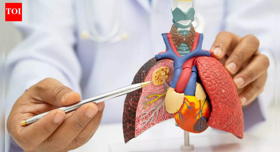 World’s first lung cancer prevention vaccine trial funded with £2.06 million to stop cancer before it starts |