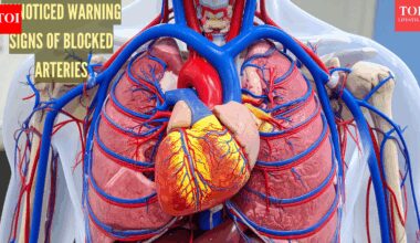 5 unnoticed warning signs of blocked arteries