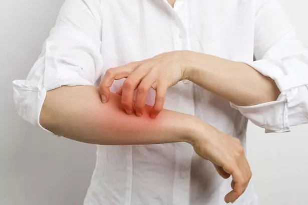 File image of person scratching their arm 