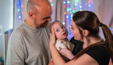 Kobi Crolla to switch on Christmas lights at Edinburgh hospital
