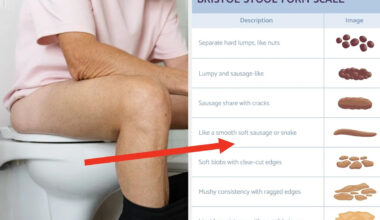 This Poop Chart Will Tell You If Your Bathroom Habits Are Actually Healthy Or If You Need To See A Doctor ASAP