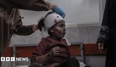 An injured Palestinian girl has her head bandaged at al-Shifa hospital in Gaza City following an Israeli strike (19 November 2025)