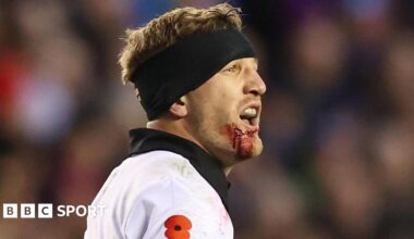 New Zealand's Damian McKenzie bleeds from a cut chin