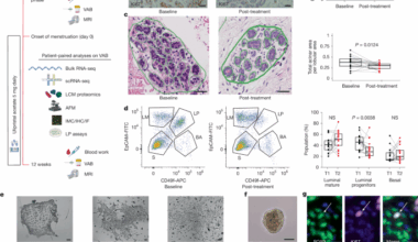 Anti-progestin therapy targets hallmarks of breast cancer risk