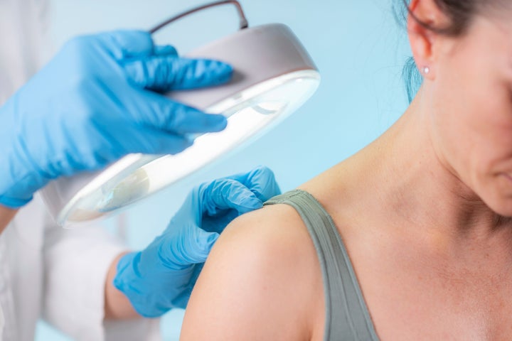 Flare-ups of any skin condition are a common response to stress.