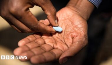 Close-up of a man's hands with a large, oval-shaped light blue pill in one of his palms.