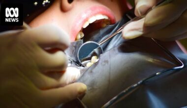 Private health insurance offered little relief for my dental woes