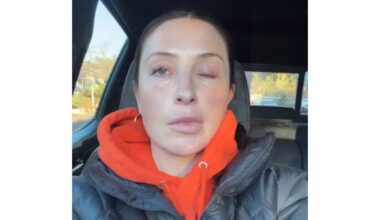 Bristol Palin Says Face Is 'Still Crooked' 1 Year After Paralysis