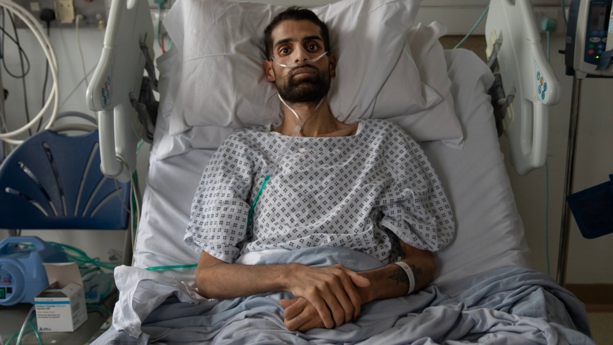 Silicosis from kitchen revamps on rise