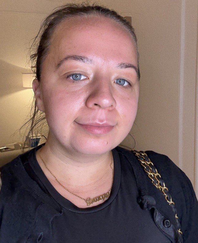 Metro's Josie Copson in a selfie after the facial, which shows her skin is now hydrated