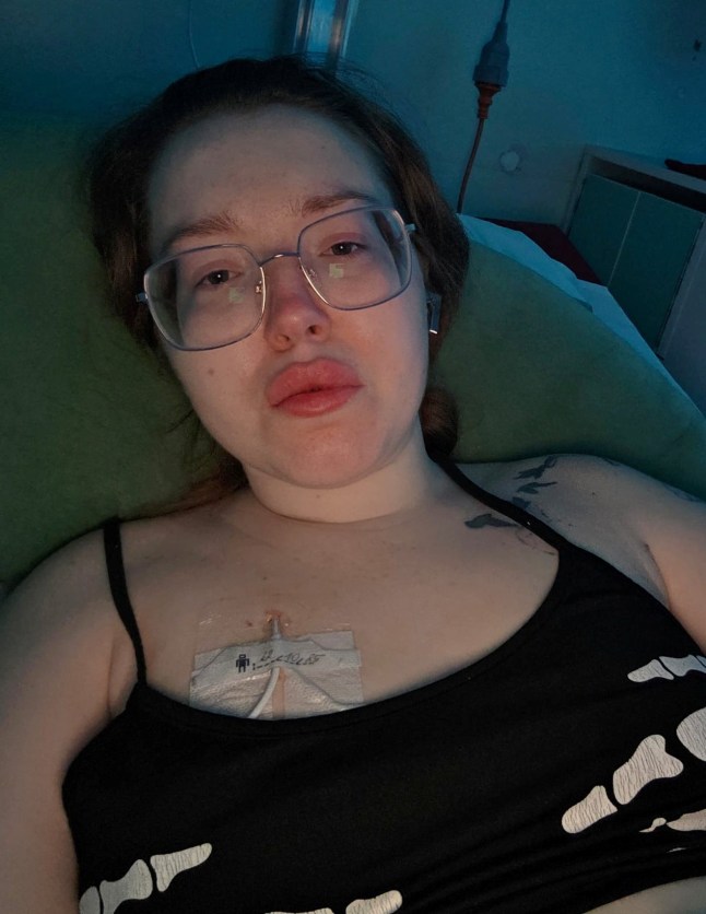 Chelsea Shields in hospital. A young mum says she awoke five days after her dream wedding to find herself partially blind, as a mystery illness started shutting down her body.Chelsea Shields, from Doncaster, South Yorks., is just 28-years-old - but says she feels more like 90 as she battles a condition called Functional Neurological Disorder (FND).Her nightmare began in August when she woke up unable to see out of her right eye - just days after tying the knot with husband Connor.Doctors feared she may have multiple sclerosis (MS) as her vision quickly deteriorated further, including in the other eye. Photo released 11/11/2025