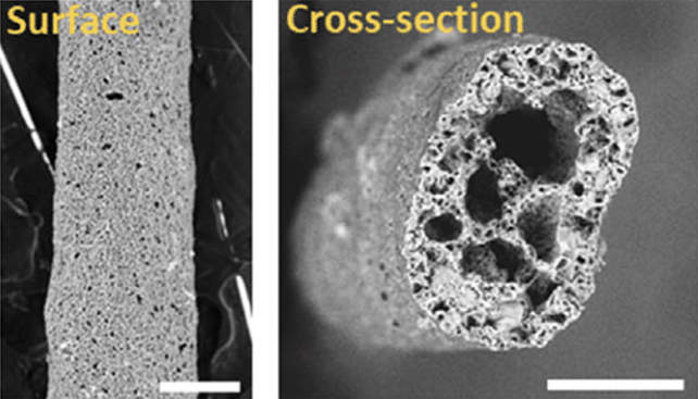 Brain structure cut out