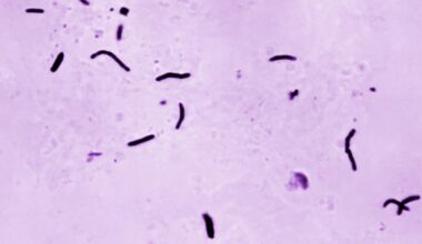 Tuberculosis kills 1.23 million people last year, WHO says | World Health Organization News