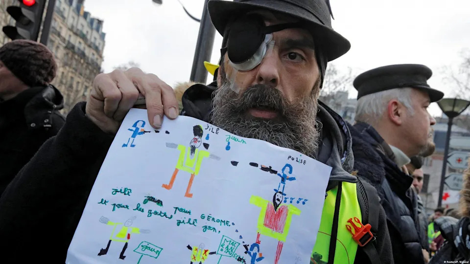 Rubber bullets do damage, too - Prominent activist Jerome Rodrigues was injured in a confrontation on January 26. Rodrigues said he was hit in the eye by a police rubber bullet, an anti-riot weapon that has become highly controversial in France. The incident led to public outrage and was one of many severe injuries that protest groups blamed on the rubber bullets.<span class="copyright">Reuters/P. Wojazer</span>