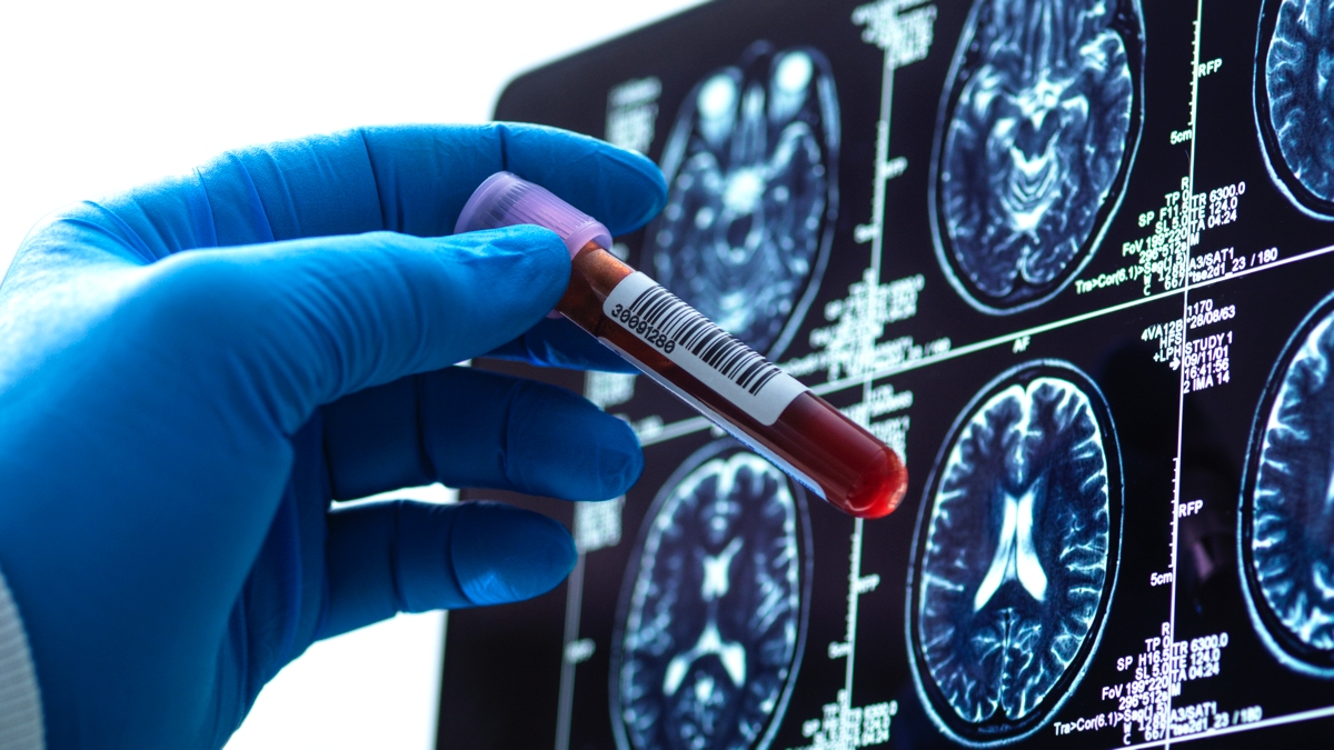 Super-Rare 'Hybrid' Blood Type Discovered in Just 3 People : ScienceAlert