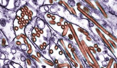 Microscope image of bird flu virus H5N1 in cells