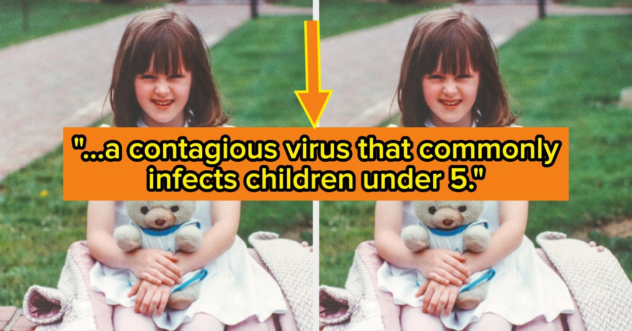 Doctors Warn About Highly Infectious Virus Outbreak