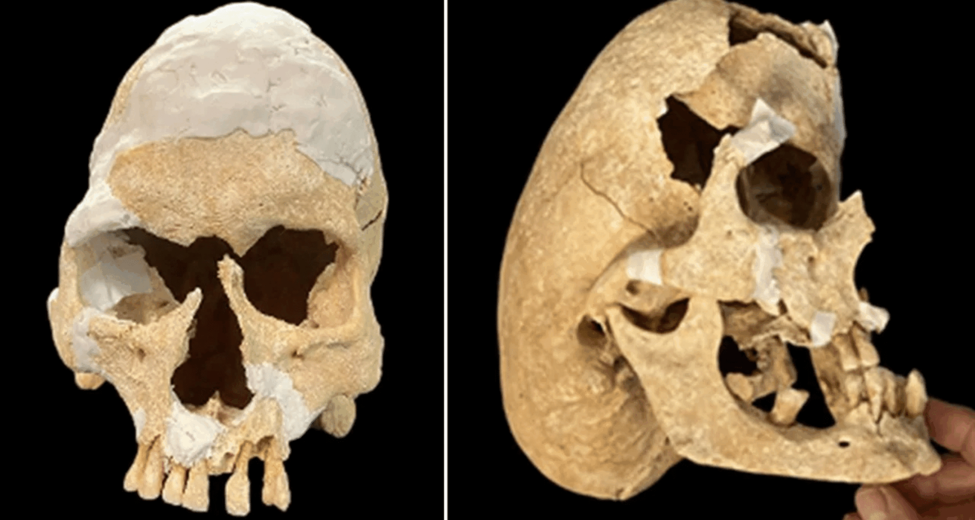 Medieval Warrior Monk With Rare Skull Shape Unearthed In Spain