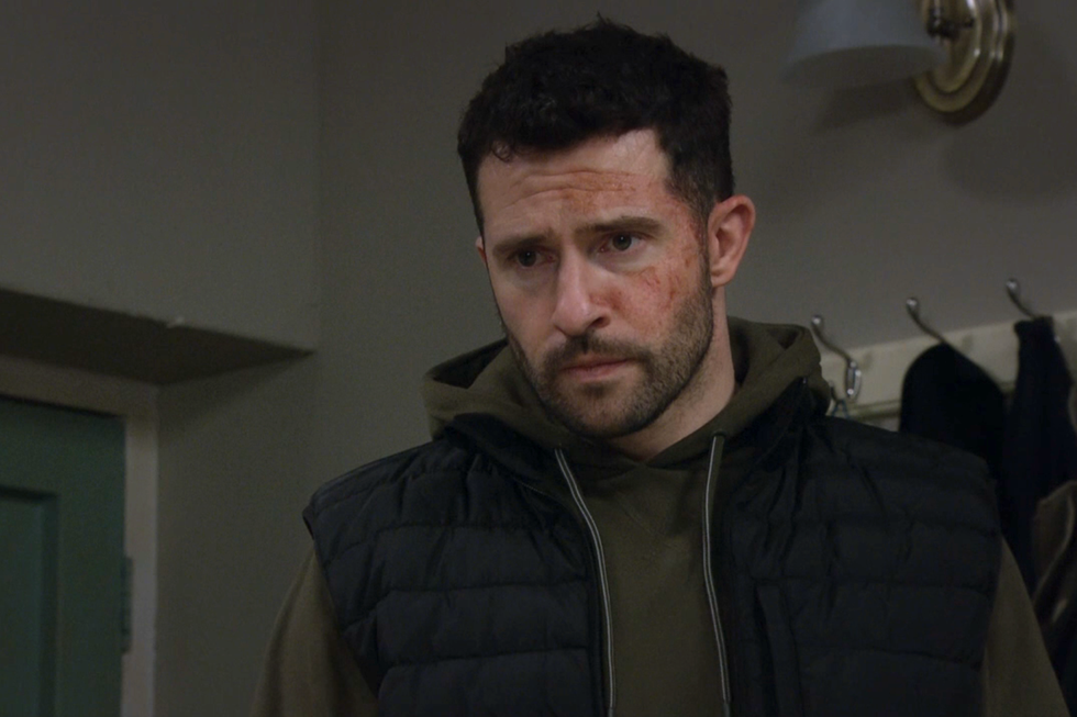 Ross Barton, Emmerdale ross barton, emmerdale