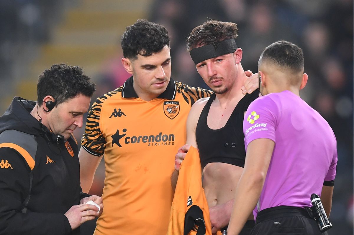Charlie Hughes needed stitches in a head wound against WBA but is OK to be involved on Boxing Day