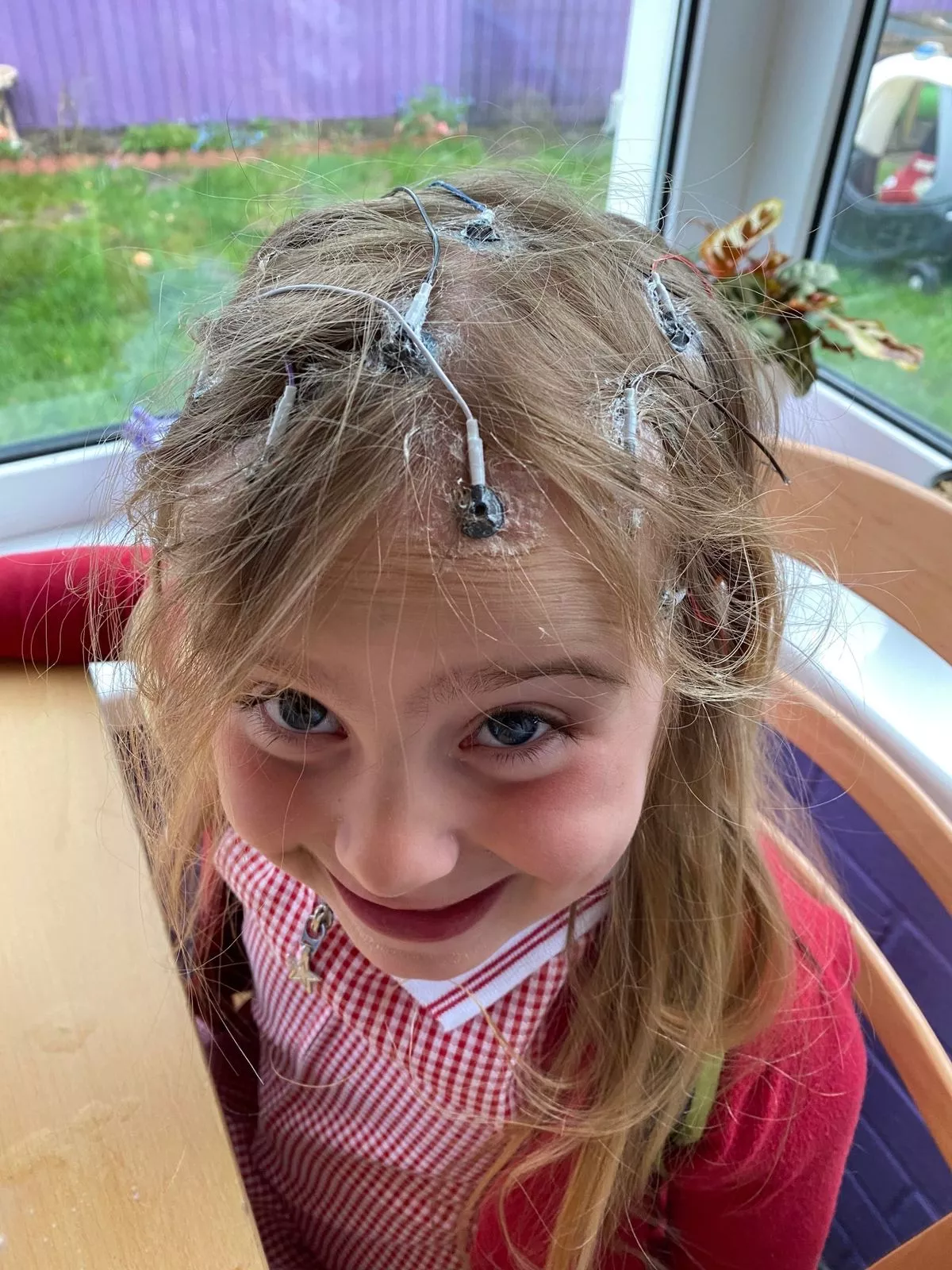 A young ten year old girl smiling up at the camera - wires connected al over her head