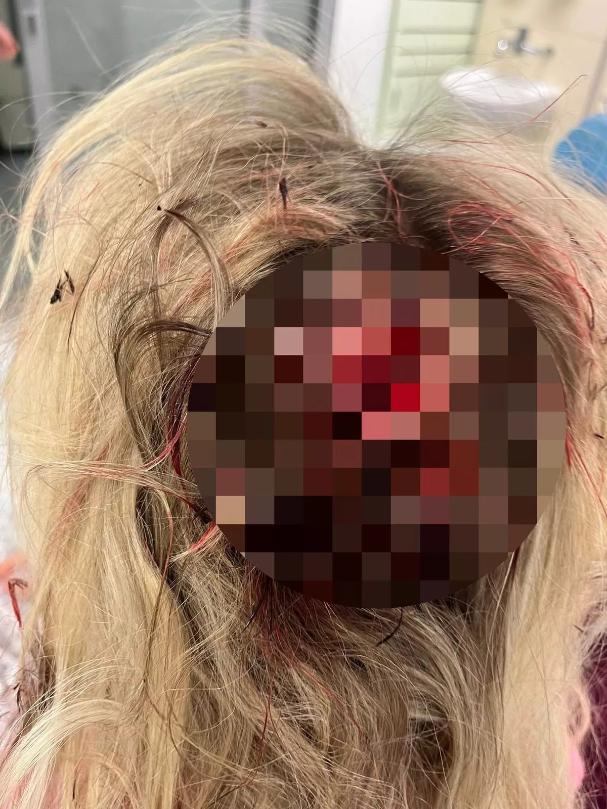 A nurse was allegedly battered from behind as she stopped to get a drink during her busy shift