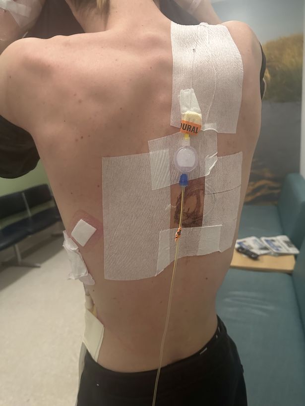 He underwent three surgeries after developing severe pains on his left side