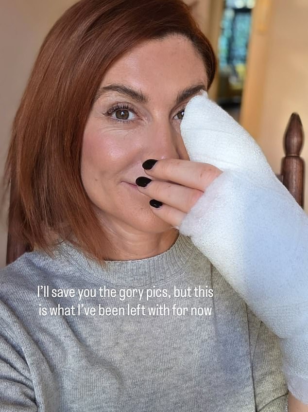 The cycling presenter added she had also been forced to have surgery on her left hand for an unrelated tendon injury