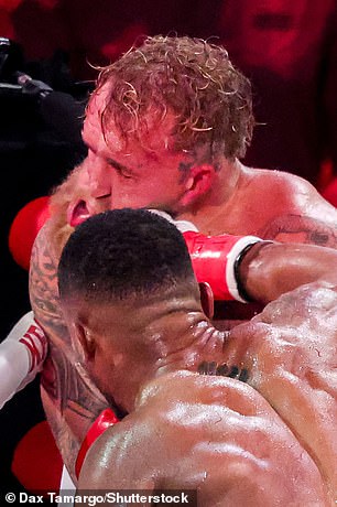 Paul was knocked out after six rounds and later shared gruesome pictures on Instagram