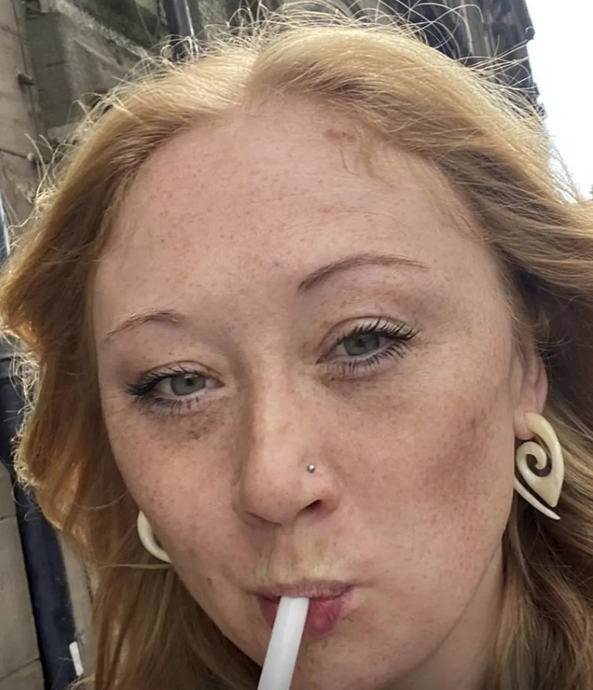 When she was 19 she decided to start using sunbeds to get a winter tan. 