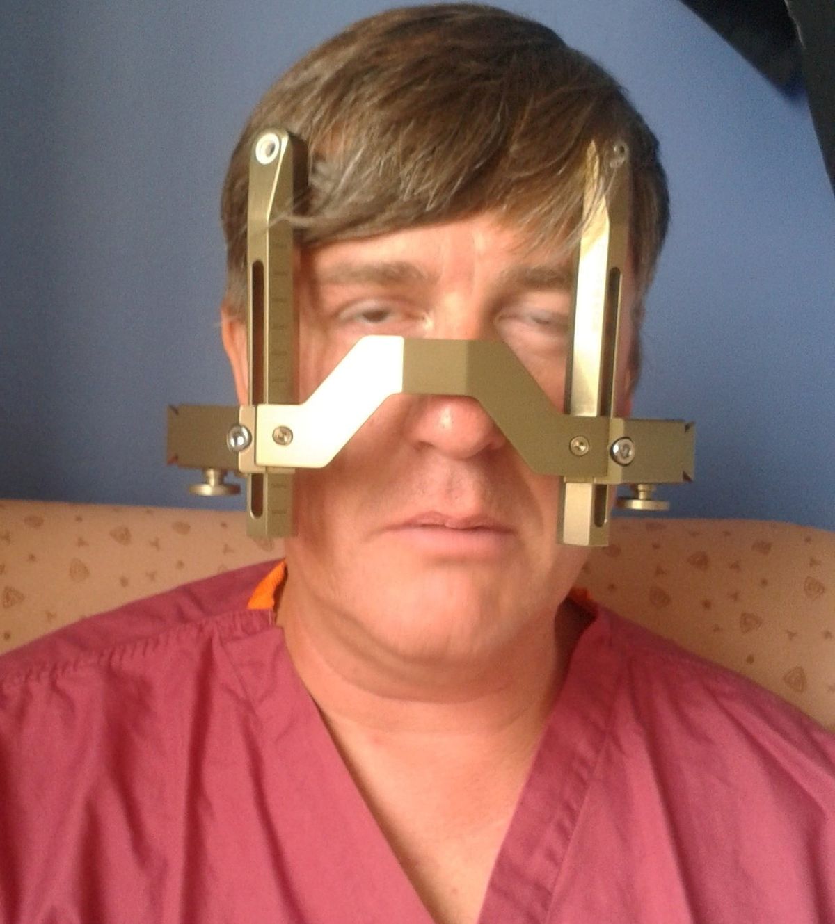 Darren Harris wearing the metal frame used in his surgery