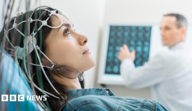 Woman lying on a medical bed wearing a cap with multiple electrodes and wires attached to the head. In the background, a healthcare professional in a white coat is examining brain scan images displayed on a monitor.
