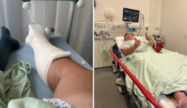 Man suing Lime after a bike accident snapped his leg
