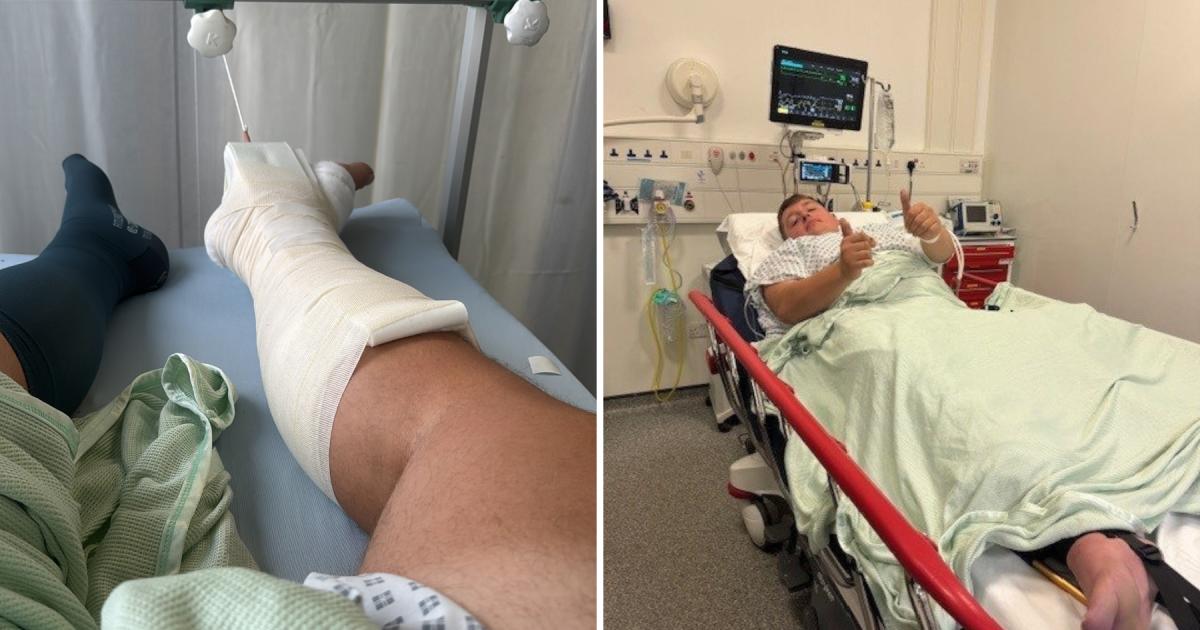 Man suing Lime after a bike accident snapped his leg