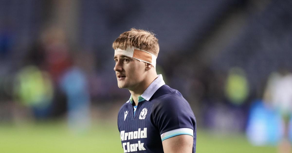 Douglas on Scotland frustration amid potential Edinburgh Rugby chance