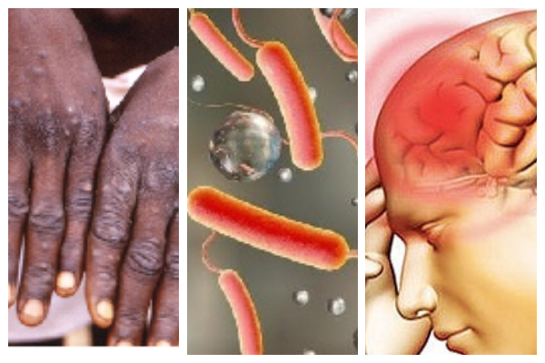 Major disease outbreaks reported across Ghana