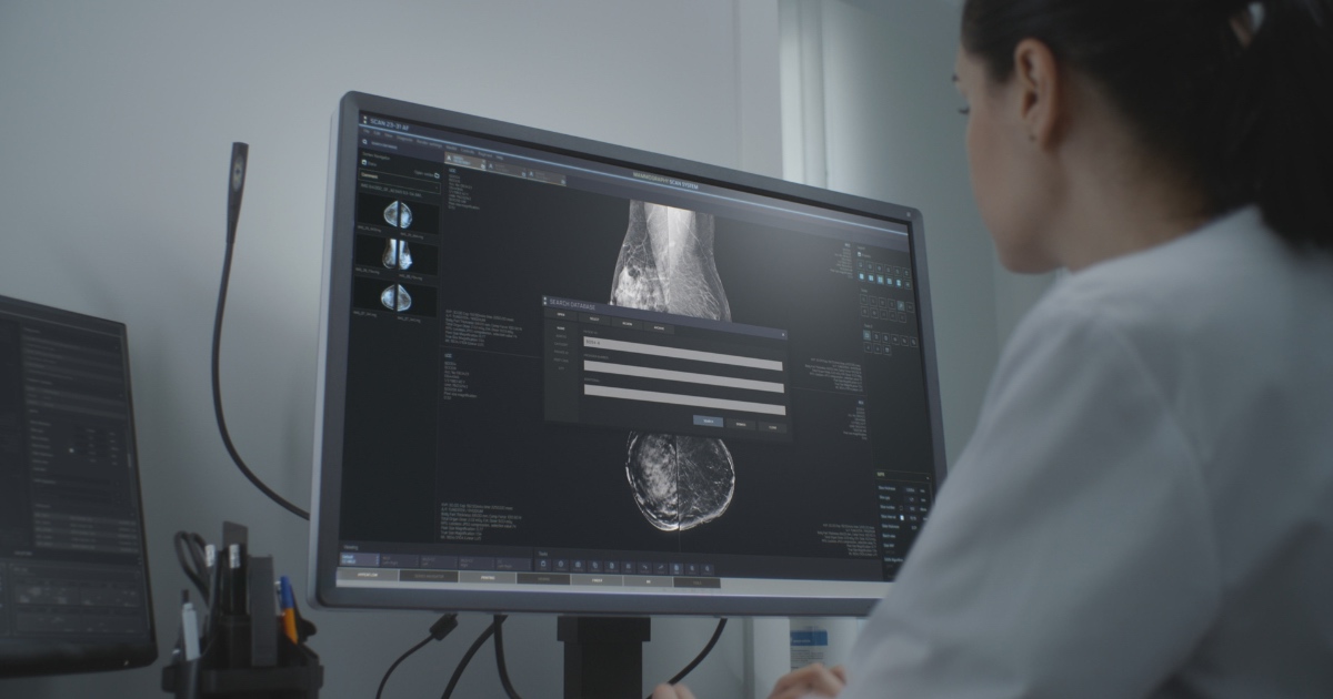 Breast cancer patients in northeast England harmed by state-run surgery unit: report • PhilSTAR Life