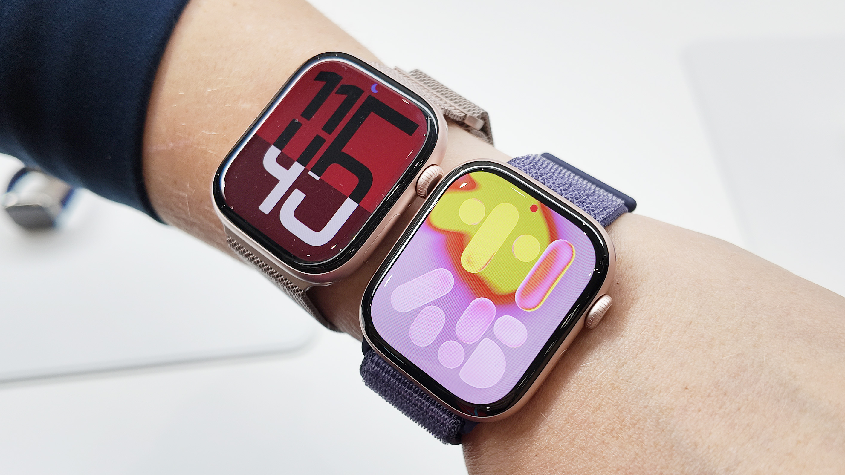 Apple Watch Series 11 close-up