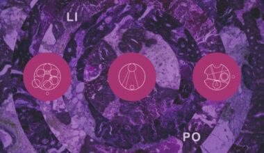 Pillars of Cacophony - Paralipomena [Things You Might Have Missed 2025]