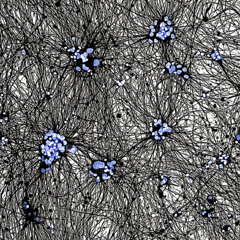 A dense network of black, branch-like lines spreads across a white background, connecting clusters of small, glowing blue dots that resemble neural or cosmic networks.