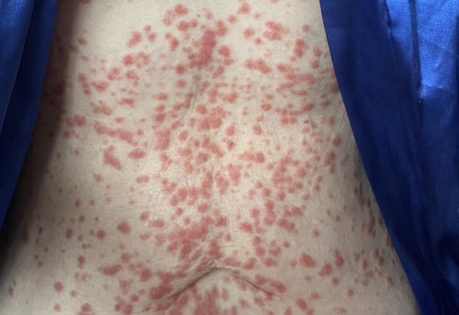 Juliette Burton ATT: Hannah Shewan Stevens - Misogynistic medical gaslighting Picture: Juliette Burton