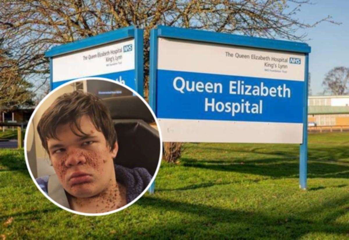 Apology issued after patient Joshua Bartlett was left to choke and seize for hours at King’s Lynn hospital