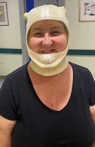 Brain Tumour Research / SWNS Pamela Cook wearing her radiotherapy mask