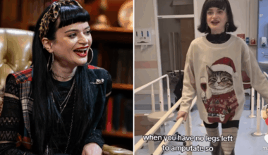 Celebrity Traitors star, 29, walks again after undergoing second leg amputation