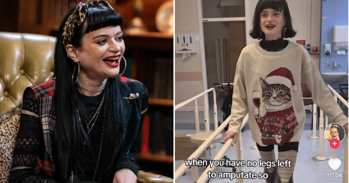 Celebrity Traitors star, 29, walks again after undergoing second leg amputation