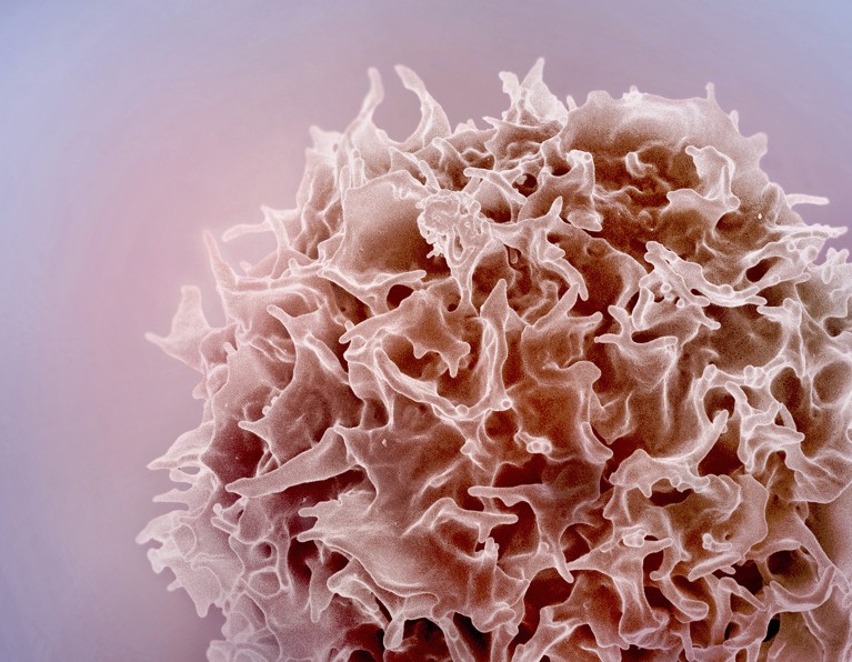 Coloured scanning electron micrograph (SEM) of a T lymphocyte (T cell) that resembles a large crumpled ball of tissue paper.