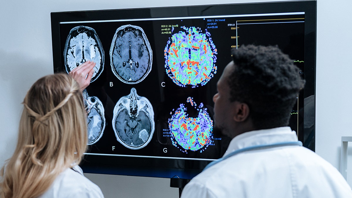 Female and male doctors examine a brain scan up on large screen in front of them.