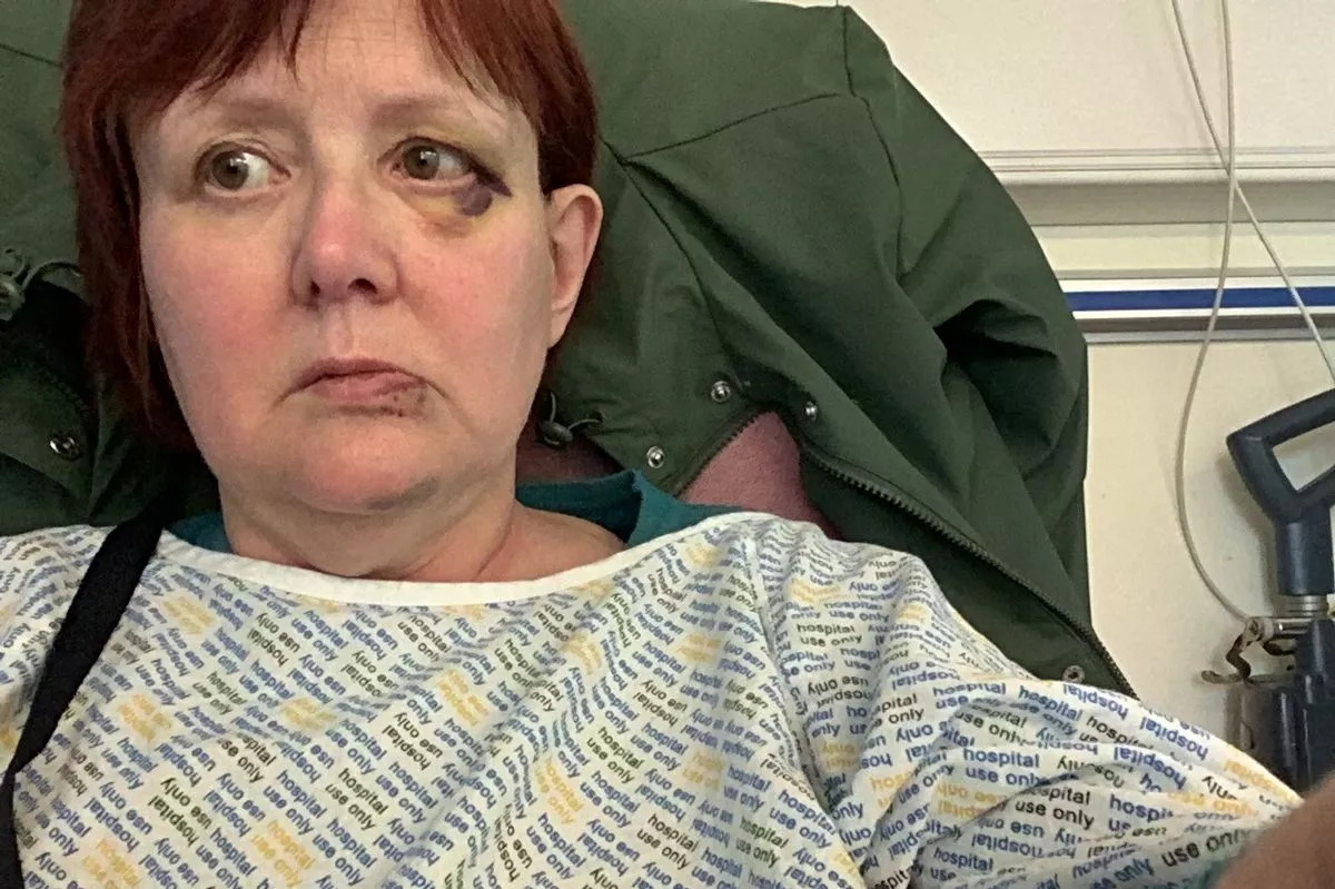 Deborah Diver suffered a bad fall outside the Glasgow Royal Infirmary in May last year.