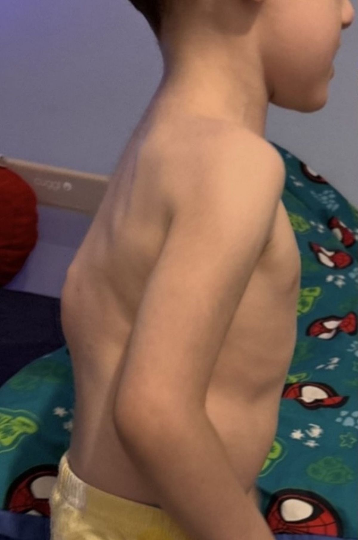 Megan West said her tot Elliot started walking 'weird' in December 2024,