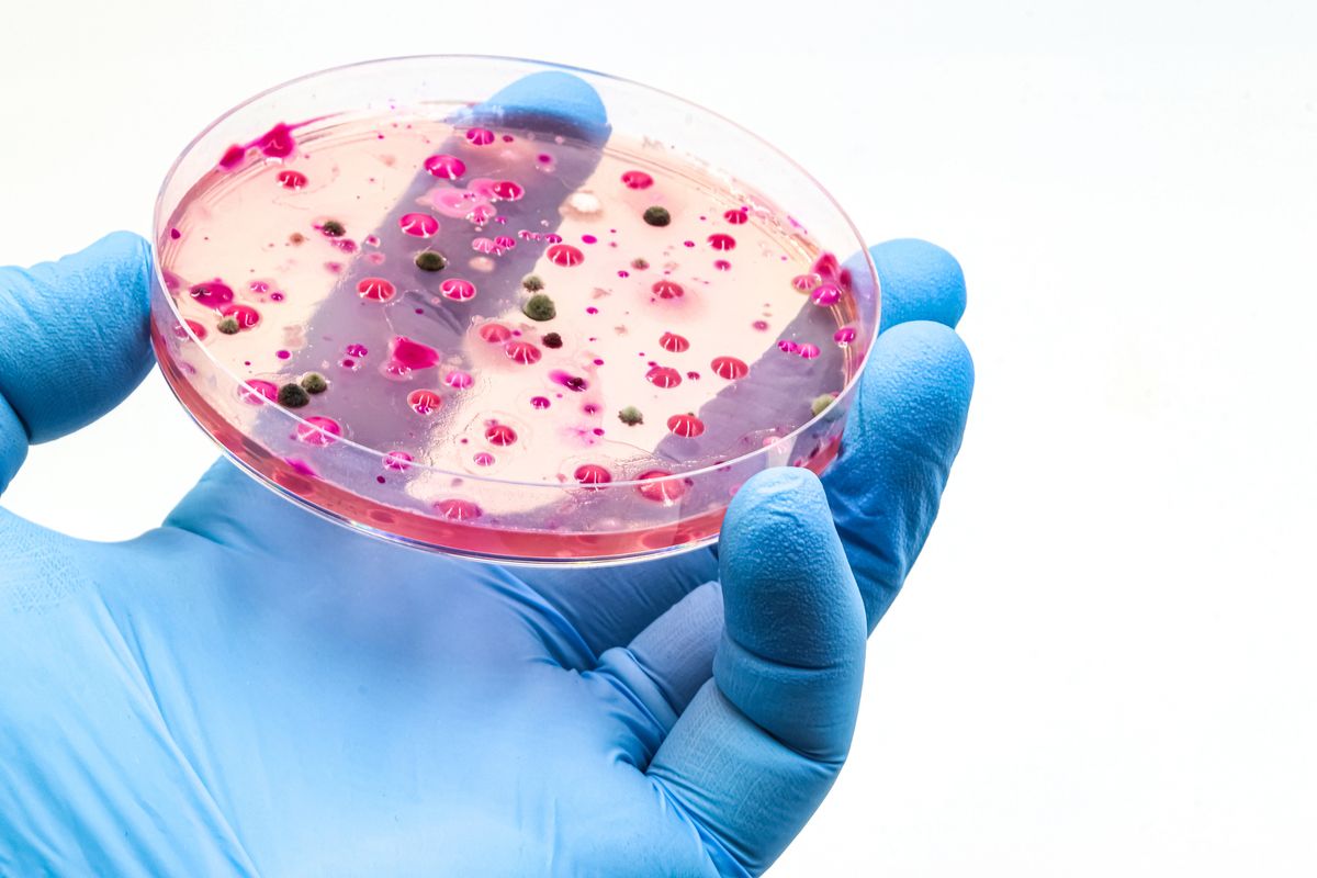 Microbiological culture with colonies of bacteria, fungi and yeasts